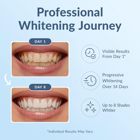Super White Dental Strips
