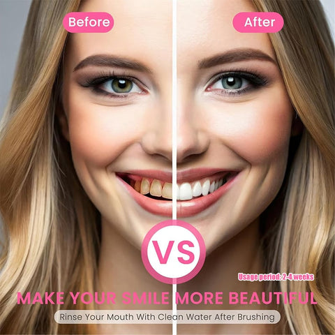 Niacinamide Whitening Toothpaste - For Healthier, Whiter Teeth!