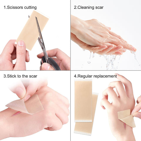 Silicone Gel Sheets for Scar
