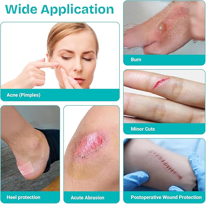 Hydrocolloid Patch Bandages for Wound & Acne Care