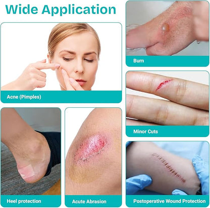Hydrocolloid Patch Bandages for Wound & Acne Care
