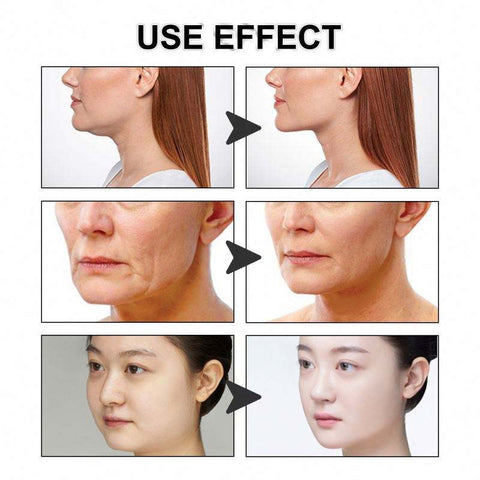 Reusable V-Face Lifting Invisible Tape